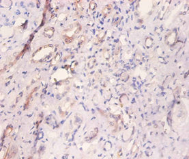MYL6 Antibody