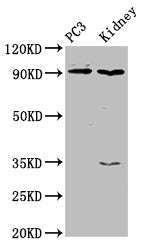 CDK11A Antibody