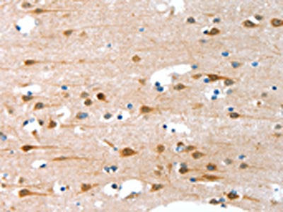 ALS2CR11 Antibody