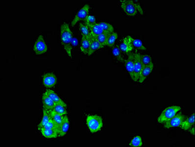 RPL10A Antibody