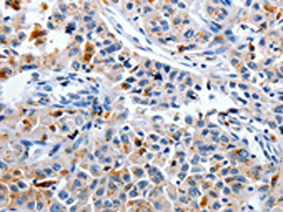 CDK3 Antibody
