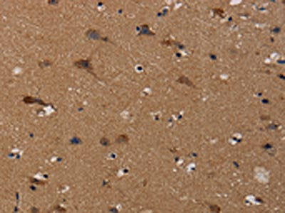 TP53INP1 Antibody