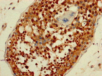 AATF Antibody