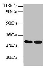 ARHGEF18 Antibody