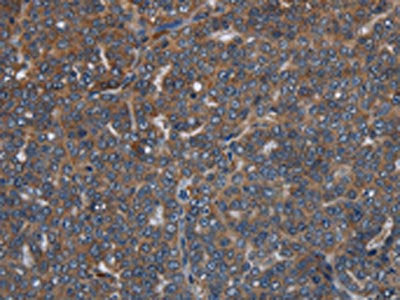 LETMD1 Antibody