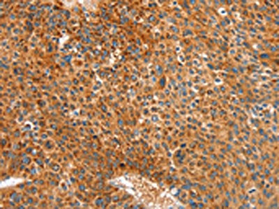 ALDH1A2 Antibody
