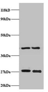 NDUFV2 Antibody