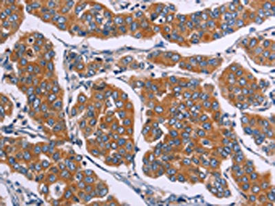 FST Antibody
