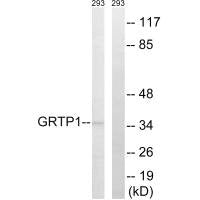 STMN1 Antibody