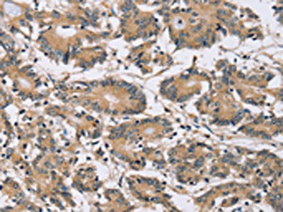 PDLIM7 Antibody
