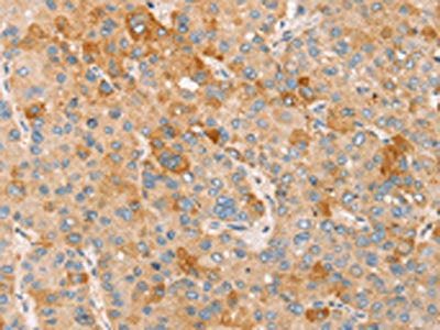 TRIM25 Antibody