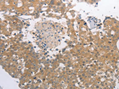 PGA3/PGA4/PGA5 Antibody