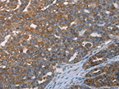 CERS4 Antibody