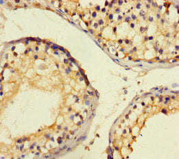 CTDNEP1 Antibody