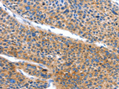 ARL11 Antibody