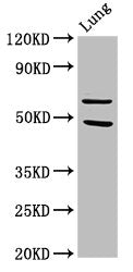 PAK4 Antibody