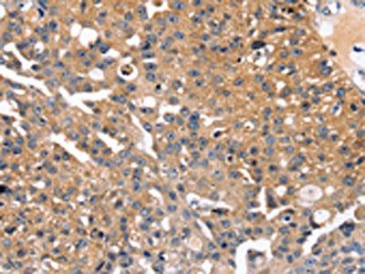 SLC2A2 Antibody