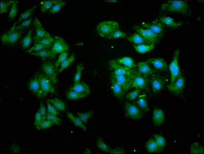 GABARAP Antibody