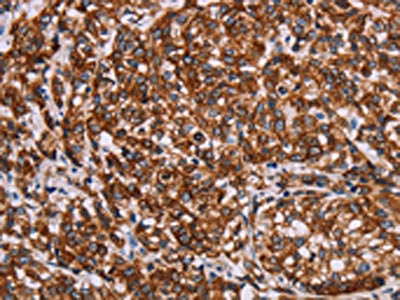 KRT14 Antibody