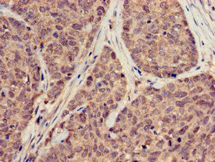 SUMO3 Antibody