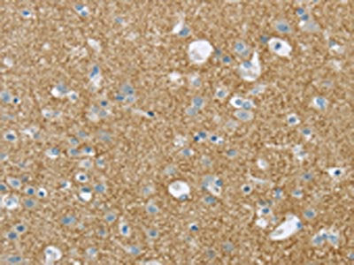 VAMP2 Antibody