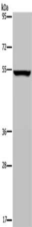 PHGDH Antibody