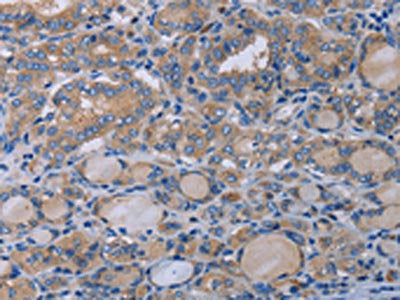 P2RX3 Antibody
