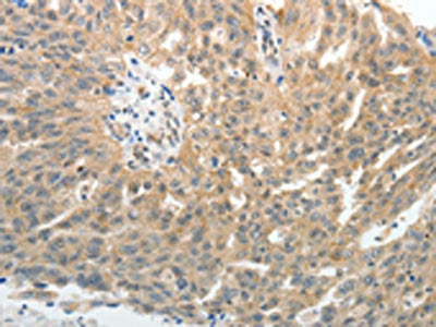 SELE Antibody