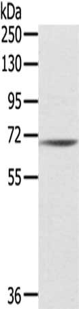 IL18R1 Antibody