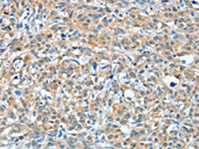 BAG3 Antibody