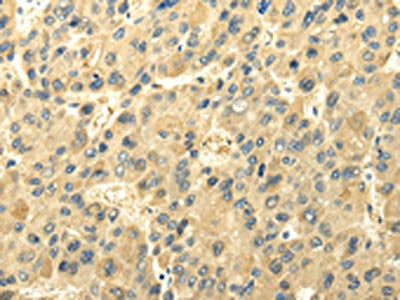 UGT1A6 Antibody