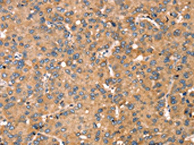 TGFB2 Antibody