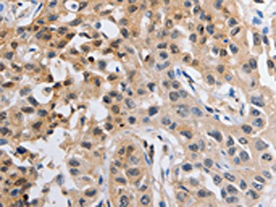 NCK1 Antibody