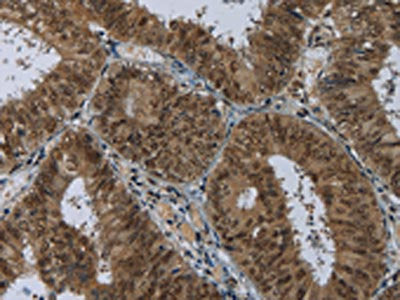 MRE11A Antibody