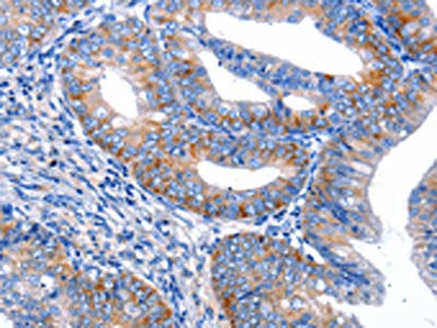 AR Antibody