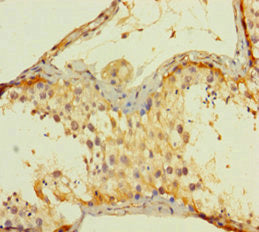 AGRP Antibody