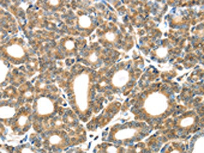 GZMK Antibody