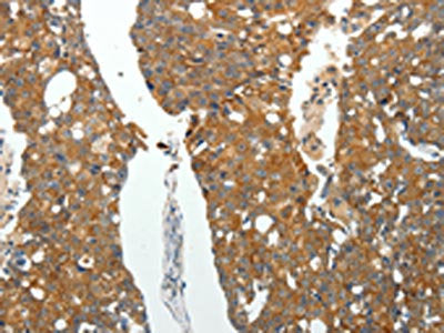 ROCK1 Antibody