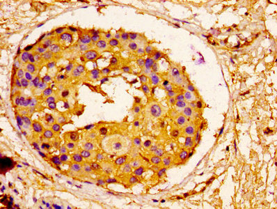 ORM1 Antibody