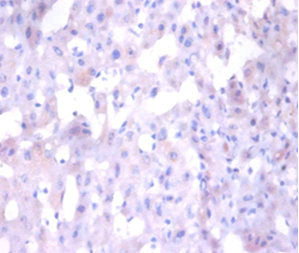 ANG Antibody