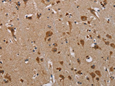 PARP3 Antibody