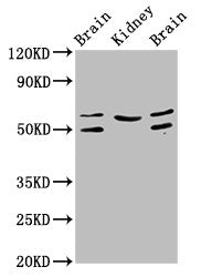 ANGPT2 Antibody