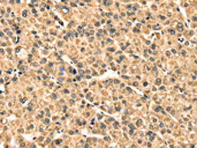 TMPRSS3 Antibody