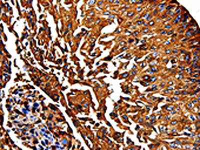 PKM Antibody