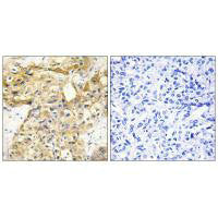 COL18A1 Antibody
