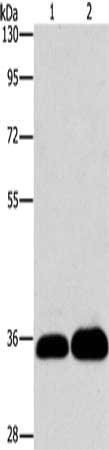 LIN28B Antibody