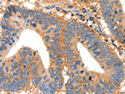 MUC6 Antibody
