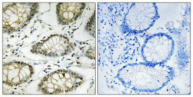 Phospho-ATR (Ser428) Antibody