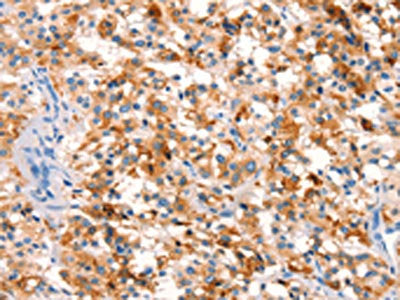 SPRN Antibody