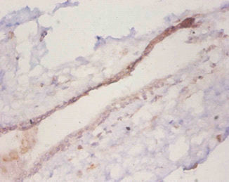 CCL2 Antibody
